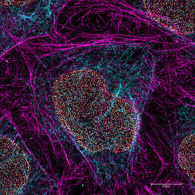 Live cell imaging at nanoscale resolution